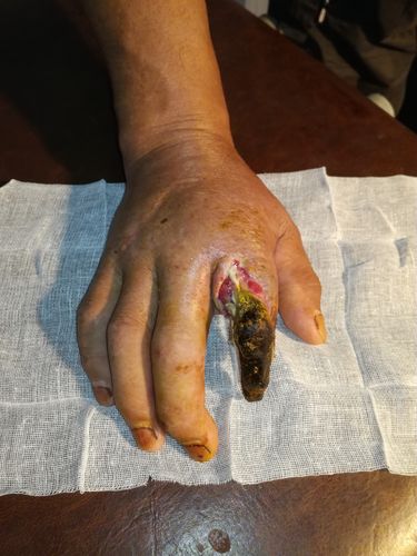 九点半9点半澳彩资料和女子遭毒蛇咬伤身亡与女子遭毒蛇咬伤身亡视频